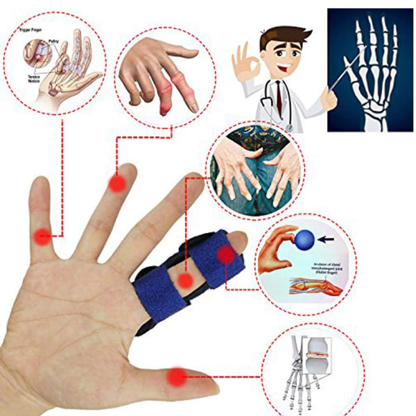 Fingerskena Trigger Finger Mallet Finger Splints Justerbart Fingerskydd med Aluminiumstöd för Fingerskarvsvärk
