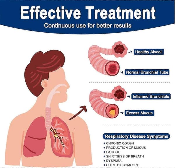 Hvid Respiratorisk Vibrations-ekspektorationsapparat