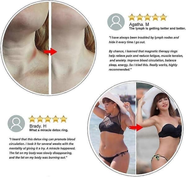 Lymfdränagering, 4 lymfdränage terapeutisk magnetisk ring, smärtlindring och minskar trötthet