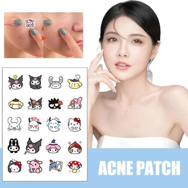 96 st Hydrokolloida akneplåster Tecknad Söt Sanrio HelloKitty Akne Finnar Ammande Plåster hellokitty 96 plåster hellokitty 96 patches