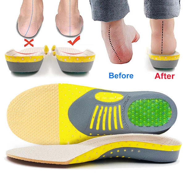 Orthopedic Insoles Orthotics Flat Foot Health Sole Pad For Shoes Insert Arch Support Pad For Plantar fasciitis Feet Care Insoles