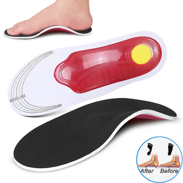 EVA Orthopedic Insoles Arch Support Flatfoot Sports Shoes Inserts Feet Cushion Pads Shoe Sole for Arch Foot X/O Leg Correction