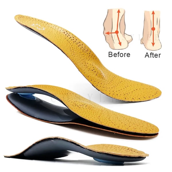 Orthotic Insole For Flat Feet Arch Support Orthopedic Leather Shoes Sole For Men Women O/X Leg Corrected Insoles