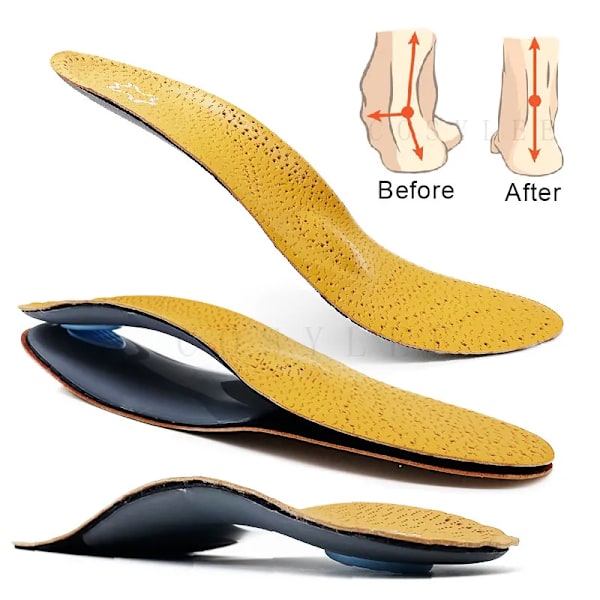 Orthotic Insole For Flat Feet Arch Support Orthopedic Leather Shoes Sole For Men Women O/X Leg Corrected Insoles