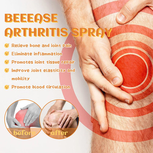 Body Therapy Bee  Led- och bensmärta terapi spray 100ml 1/3/10PCS orangeA 100ml