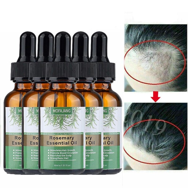 5 st Ekologisk rosmarin eterisk olja för hårväxt 100% naturligt ger näring till håret