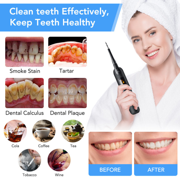 Tandrengöring Plackborttagningsmedel för tänder, tandstensborttagningsmedel för tänder Tandrengöringsmedel - Hjälper till att ta bort tandsten, tandsten, fläckar, plack - Tandrengöringsverktyg