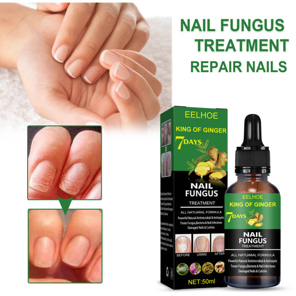 Renewal Nail Repair Solution med ingefära för missfärgade och skadade naglar-50ml