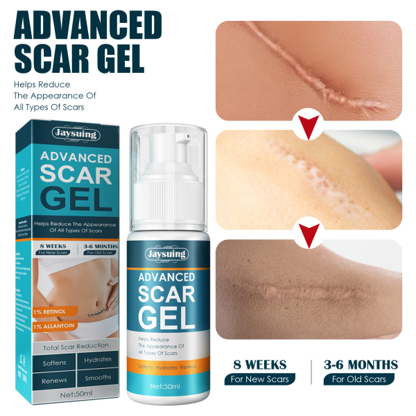 Advanced Scar Cream for Body - Hjälper mot akne och operationsärr, bristningar, skärsår, brännskador - Ärrborttagningskräm för gamla och nya ärr - Vitamin