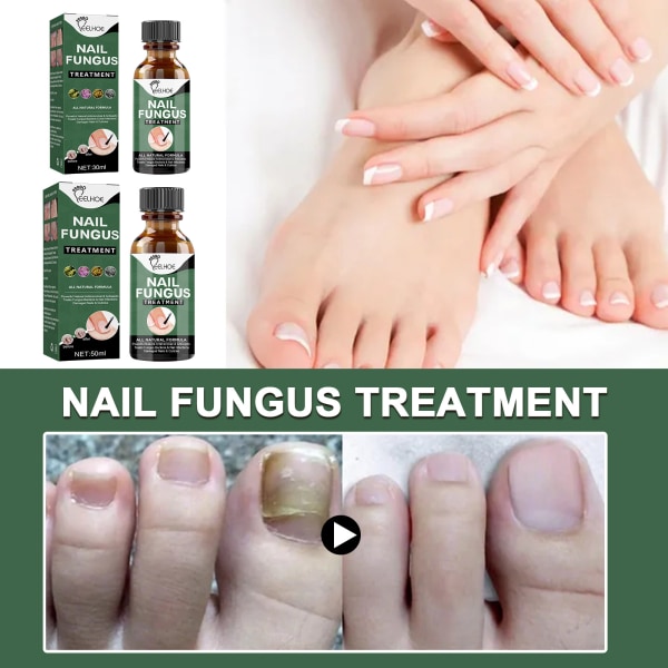 Extra Strength Nagelreparationsvätska för tånagel och fingernagel, Nagelreparationslösning för tjocka spruckna missfärgade naglar, Återställ friska naglar