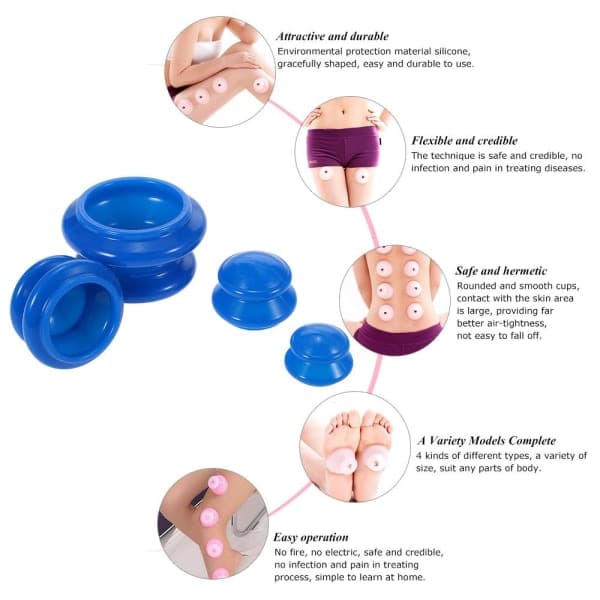 Cupping Therapy Sæt til Fuld Kropsmassage – 4 stk. Silikonekopper, Størrelser XS–L, Hvid