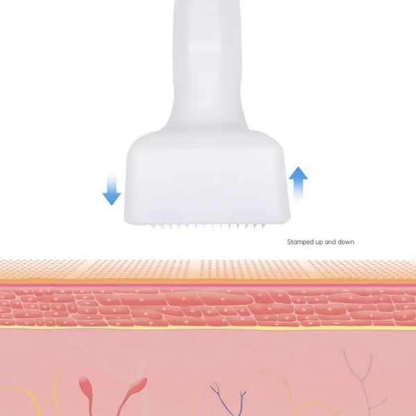 Justerbar Microneedling Derma Stamp - 140 Titanpinner Profesjonell Mikronål