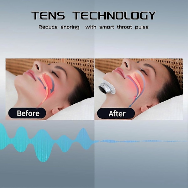 Smart Anti-Snorke Enhed, Elektrisk Snorke Stopper Enheder EMS Hals Massager, Komfortabel Stop Snorke Hjælpemiddel Løsning for Bedre Søvn