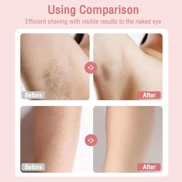 Elektrisk barbermaskin for kvinner, smertefri hårfjerning, 2-i-1 epilator og barbermaskin, vanntett for våt og tørr bruk, ansikt, bikini, underarmer