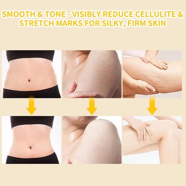 Elektrisk lymfemassage – Dybdegående cellulitemassage & kropsmassage med display