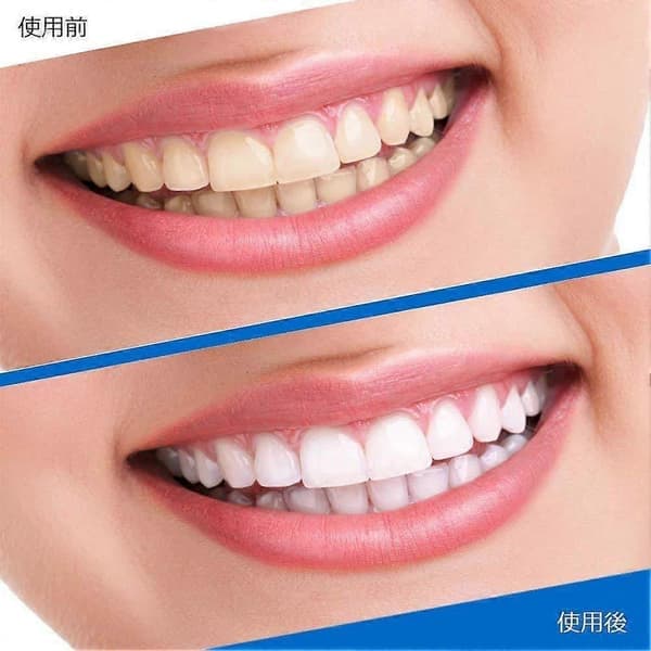3D White Dental Fluiding Strips Professional Effects - Bleker tenner, White Luxe 10 par