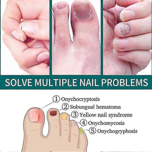 1-3 st borste 2 i 1 behandla naglar 5 ml 2PCS