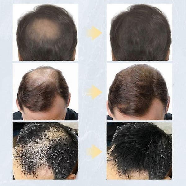 Hårfibrer Keratin Topic Förtjockande Spray Hårbyggande Fibrer mediumbrown