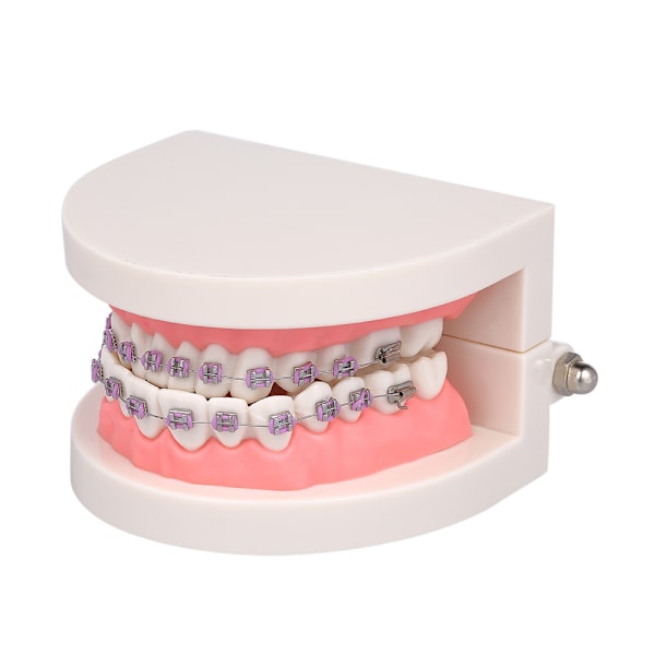 Tandmodell för Malocclusion med Ortopediska Stöd
