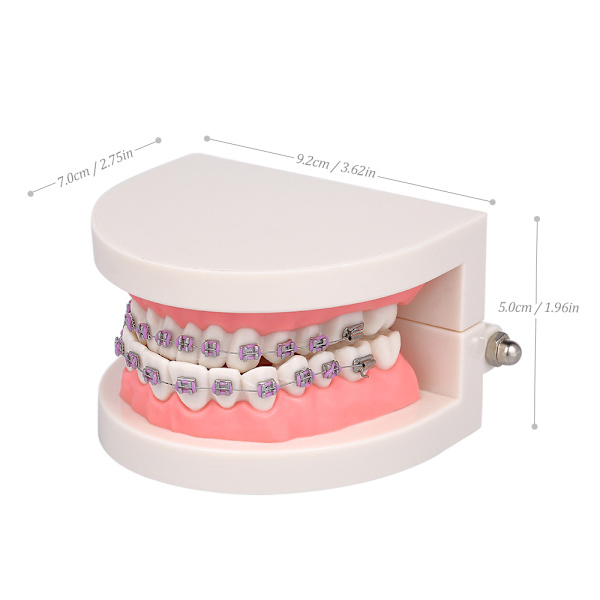 Tandmodell för Malocclusion med Ortopediska Stöd