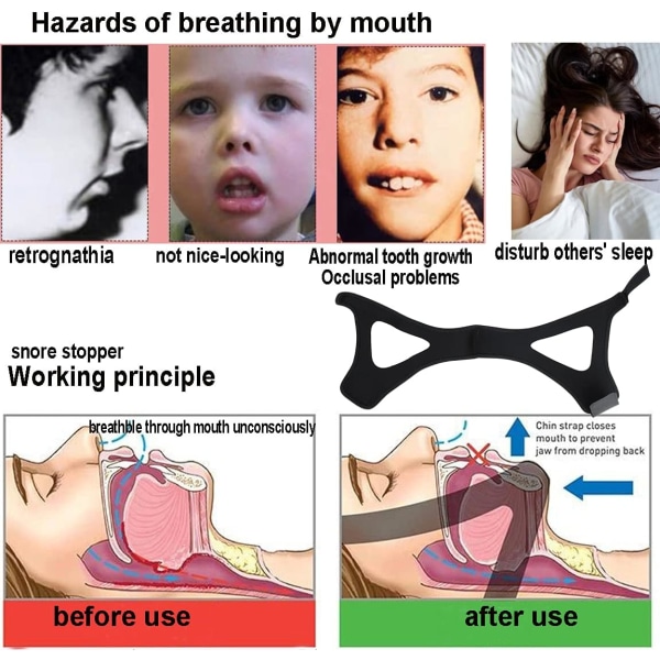 Ett stykke sort pustende Anti Snoring Chin Strap, Stop Snore Ch