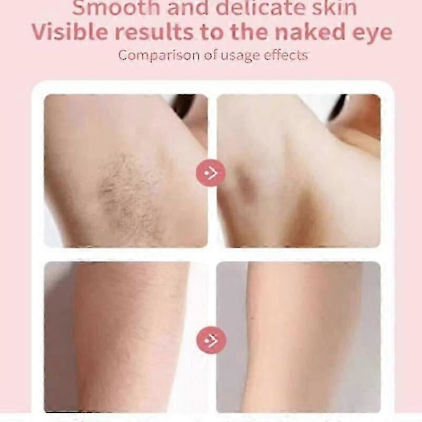 Lumisylk Pro Ansikts Epilator, Lumivyx Lumisylk Pro Hårfjernare Epil Pro 3.0