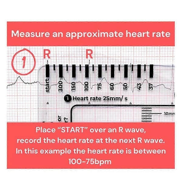 2 ST ECG 7-stegslinjaler, ECG 7-stegslinjal för EKG/EKG-tolkning, EKG-linjal, bärbar EKG-bedömning