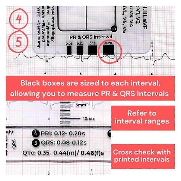 2 ST ECG 7-stegslinjaler, ECG 7-stegslinjal för EKG/EKG-tolkning, EKG-linjal, bärbar EKG-bedömning