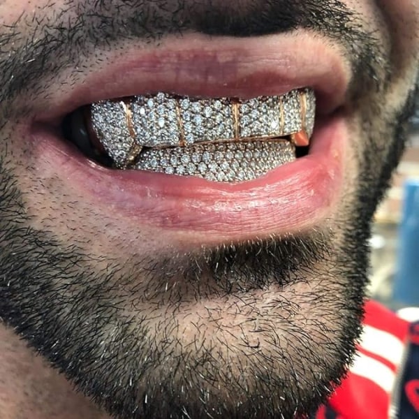 Diamond Grills til tennene dine Kvinner 18K gullbelagt Fullt Iced Ou