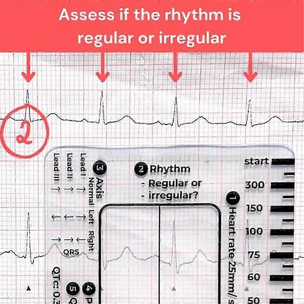 2 ST ECG 7-stegslinjaler, ECG 7-stegslinjal för EKG/EKG-tolkning, EKG-linjal, bärbar EKG-bedömning