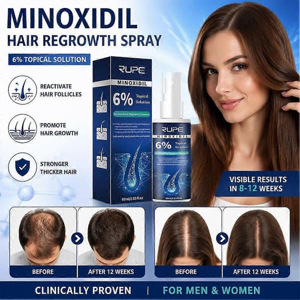 Minoxidil 6% Hårvekstløsning - Topisk, Spray, Unisex