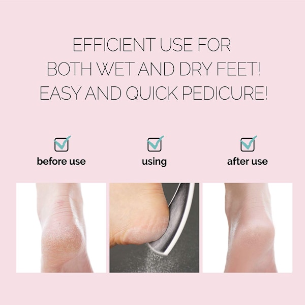Emery Fodfil, Kolossal Dobbeltsidet Pedicureværktøj, Ergonomisk Design til Nemt Greb. Pink Oval