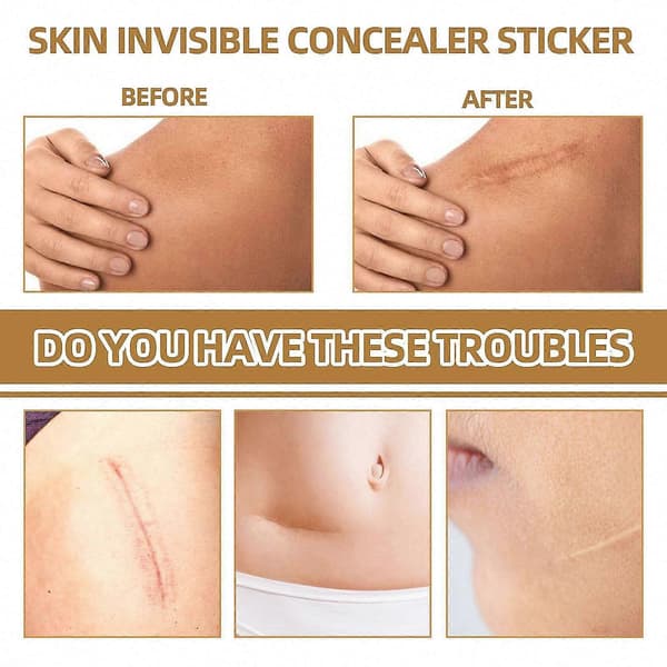 Vanntett usynlig concealer-klistremerke for arr, tatoveringer og aknemerker