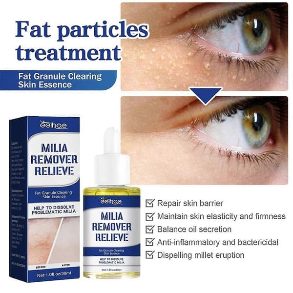 Miliafjerner, Milia for øye, Milia, talg 30ml