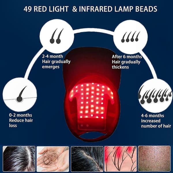 Unisex hårbehandlingsmössa med 48 LED-lampor för att främja hårväxt.