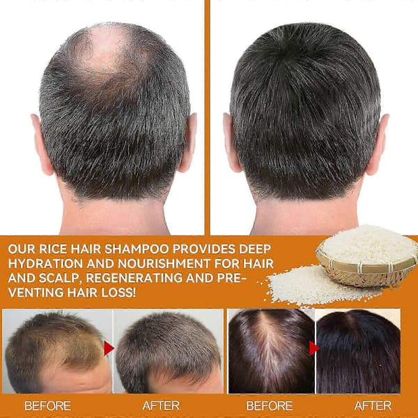 Hårvækstshampoo med biotin, risvand og rosmarin.