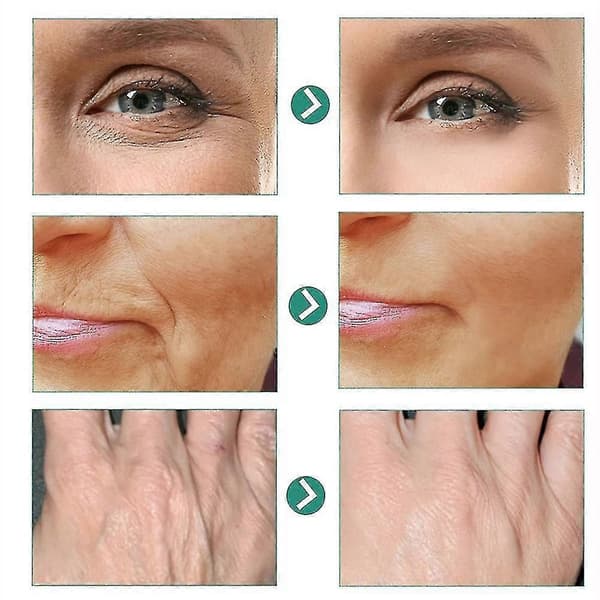 5-sekunders Retinol Anti-rynkekrem: Umiddelbar anti-aldring, oppstrammende, løftende og rynkereduserende ansiktskrem. 2