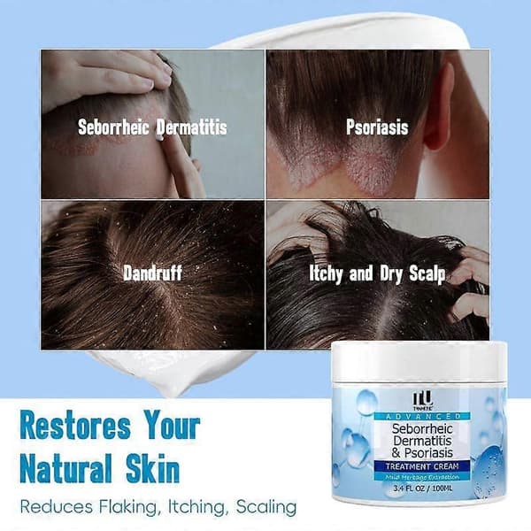 Mjällschampo + krämset för seborroisk dermatit, svampdödande schampo, hårbottenvård, lämplig för psoriasis och follikulit.