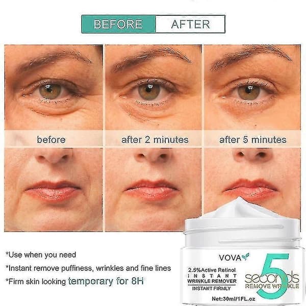 5-sekunders Retinol Anti-rynkekrem: Umiddelbar anti-aldring, oppstrammende, løftende og rynkereduserende ansiktskrem. 2