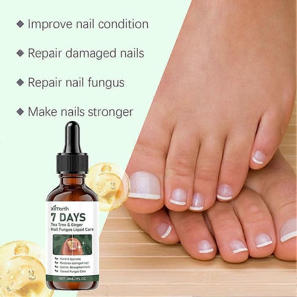 7-dagars Tea Tree Ingefära Nagelväxtessens, Svampdödande Nagel- och Tånagelvårdslösning 3