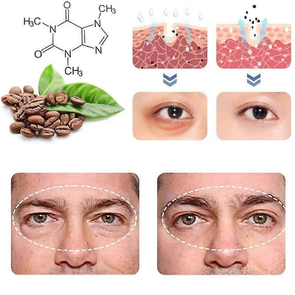 1-5 ark OPENEYES Awakening Peptide Lifting Eye Gel 2