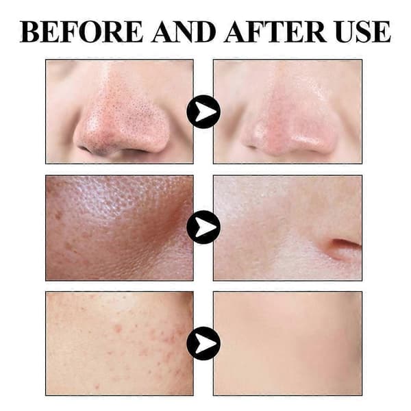 1X Burot Anti Porer og Akne Leirmaske Stick