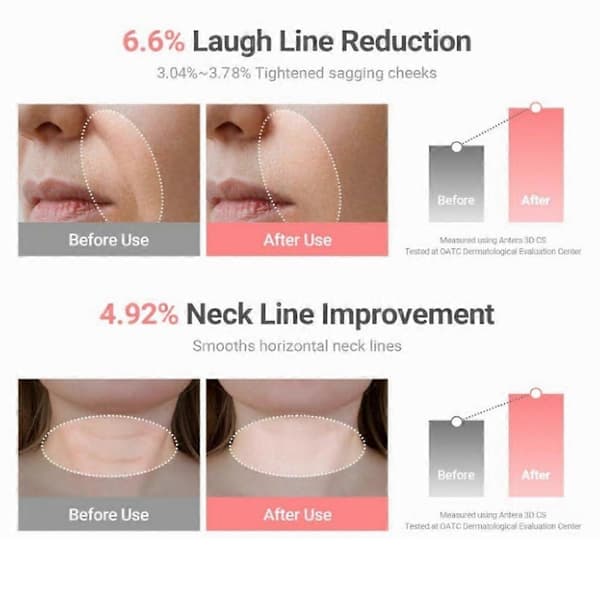 1-3x 2026 New Wrinkle Bounce Multi Balm Stick 9g