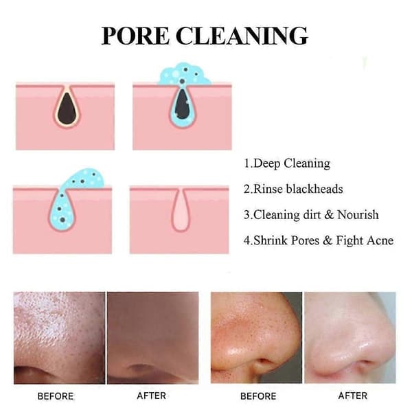 1X Burot Anti Porer og Akne Leirmaske Stick