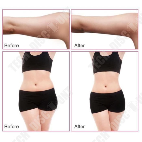 Ultralydmaskine til cavitation og fjernelse af cellulite, fedtkrop R.F skønhedsmaskine til ansigtsløftning EU-stik
