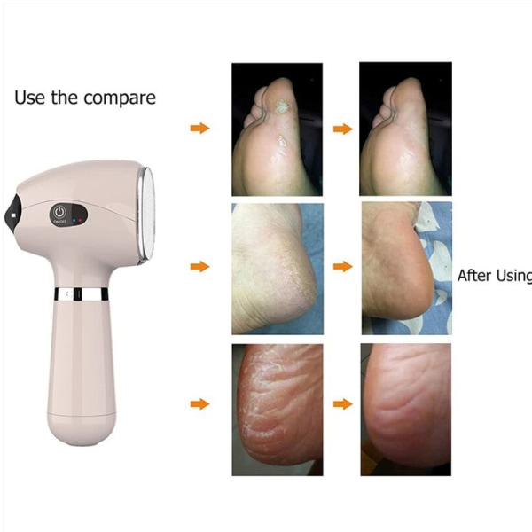 Elektrisk Foot Callus Remover, Bärbar Elektrisk Foot Sliper, Fo