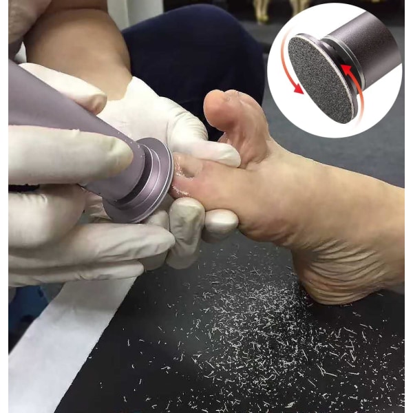 Elektrisk Pedicure Fodfil Callus Remover Elektrisk Horn Fod Fi