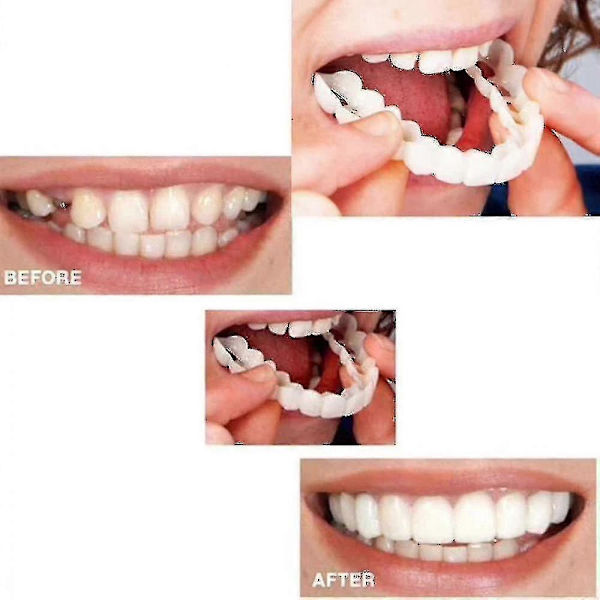 EVAGO Perfekt Smile Fanér Komfort Passform, Flex Tandprotes Pasta Tandställning