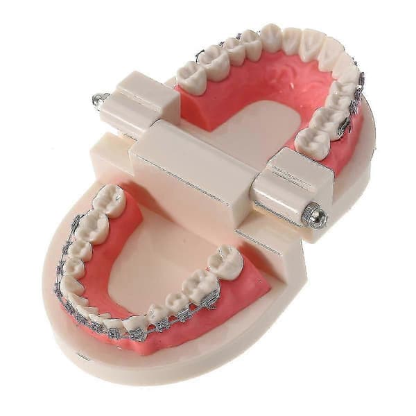 Dental Ortodontisk Modell för Tandfelställning med Fullständiga Metallfästen Bågar Tandläkarundervisning