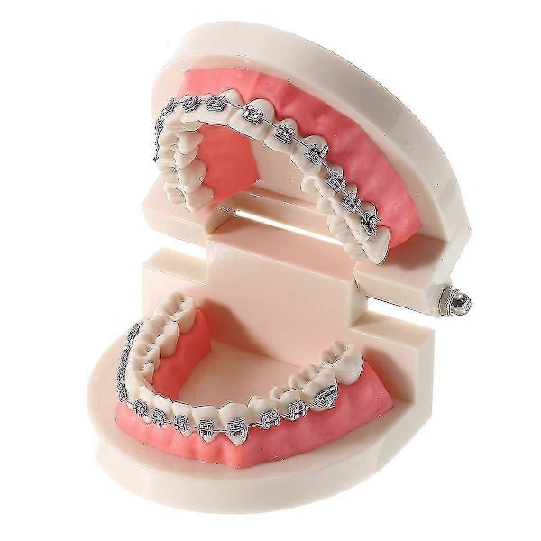 Dental Tand Malokklusion Ortodontisk Model Med Fuld Metal Bøjler Bøjler Tandlæge Undervisning